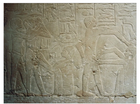      이집트 고대 벽화 중 안크마호르(Ankhmahor)의 묘에 남아 있는 할례 장면이 가장 유명하다.